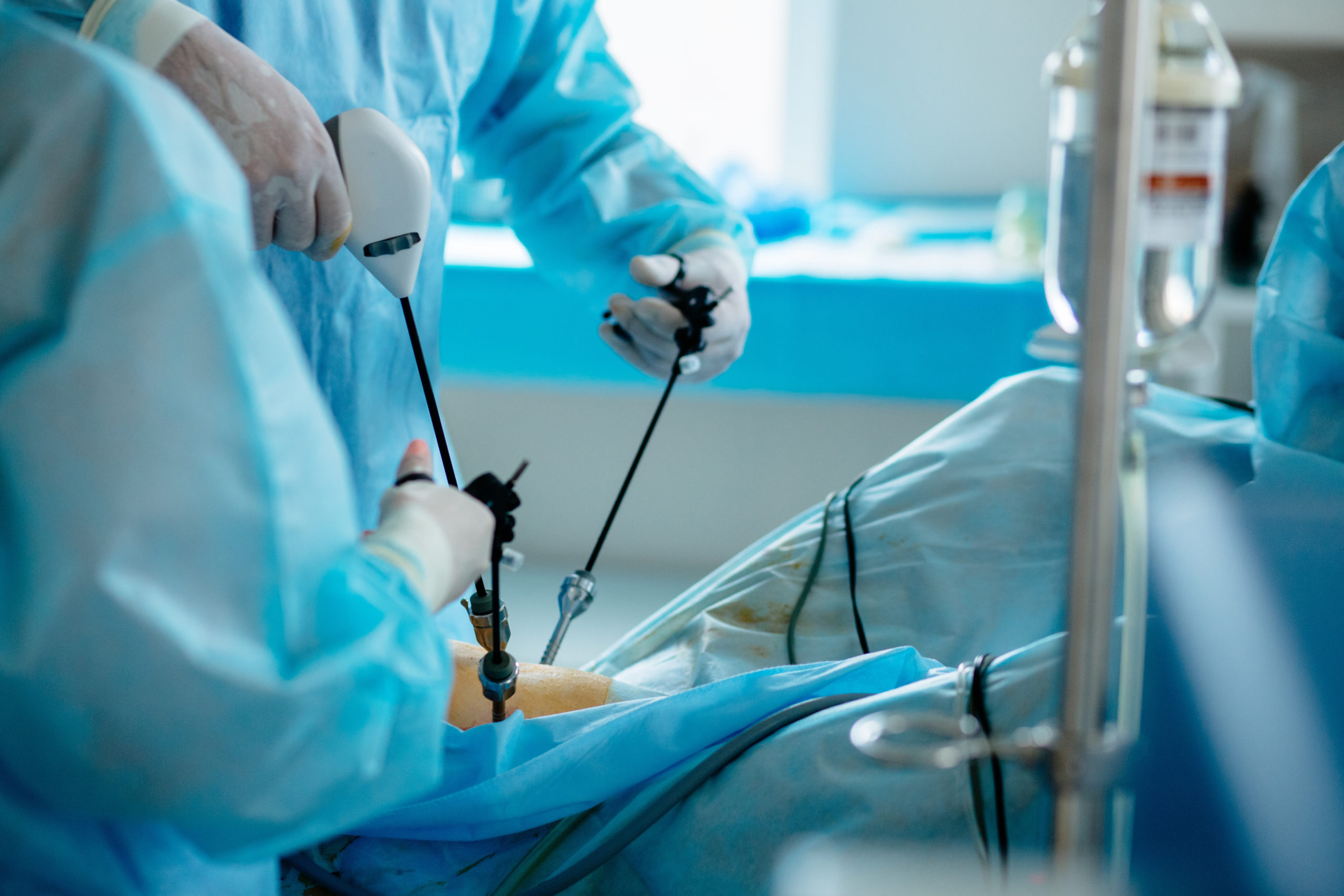 Unrecognizable surgeon's holing the instrument in abdomen of patient